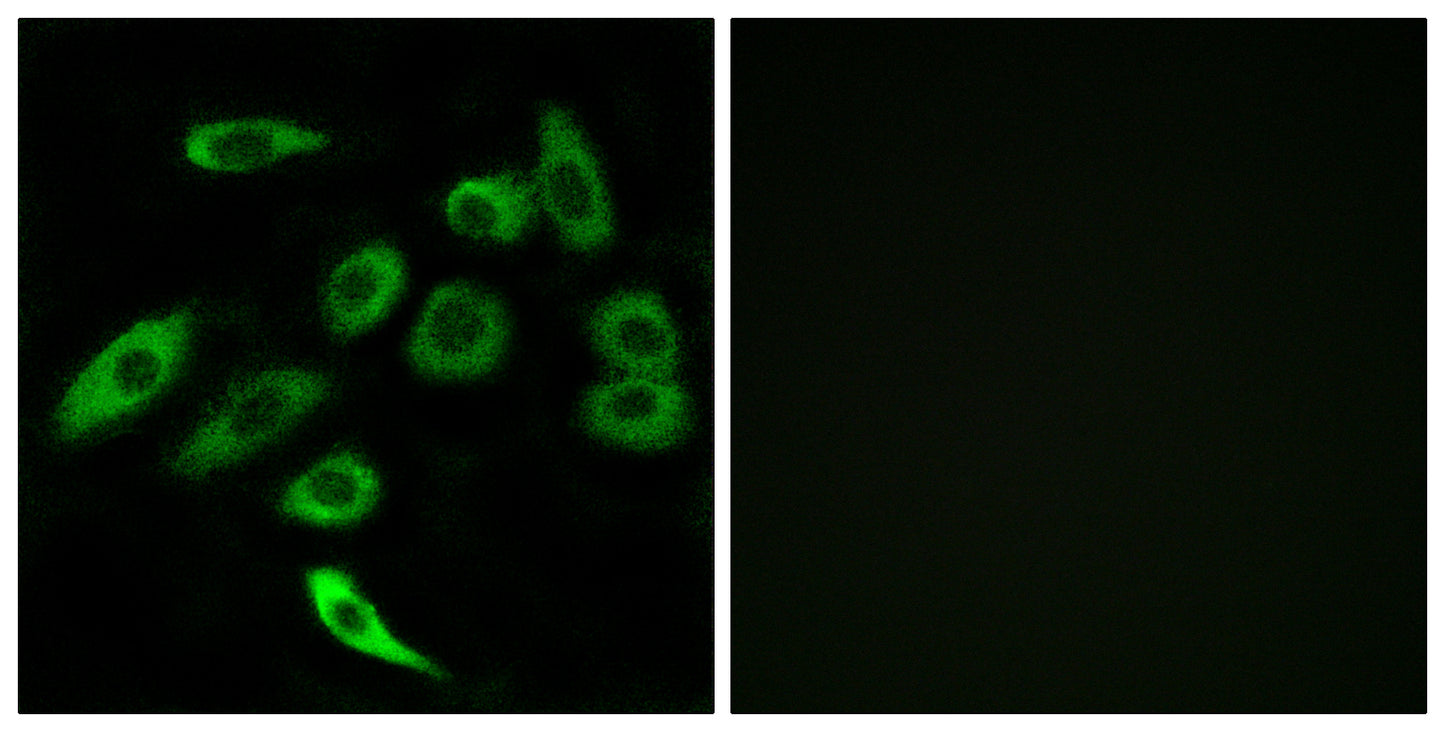 T2R3 Rabbit Polyclonal Antibody