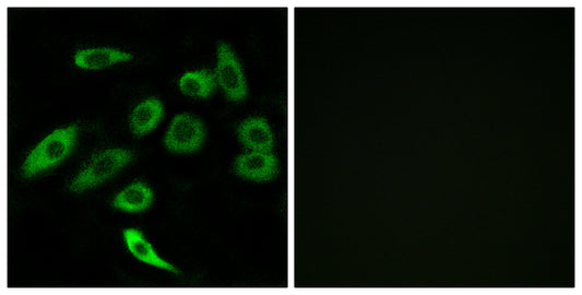T2R3 Rabbit Polyclonal Antibody