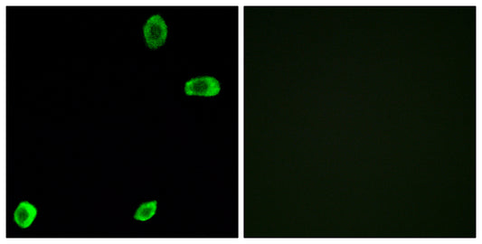 T2R39 Rabbit Polyclonal Antibody