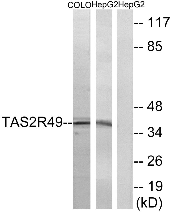 T2R49 Rabbit Polyclonal Antibody