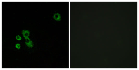 T2R7 Rabbit Polyclonal Antibody
