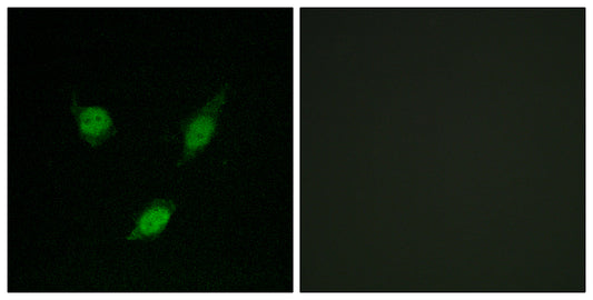 TACC1 Rabbit Polyclonal Antibody