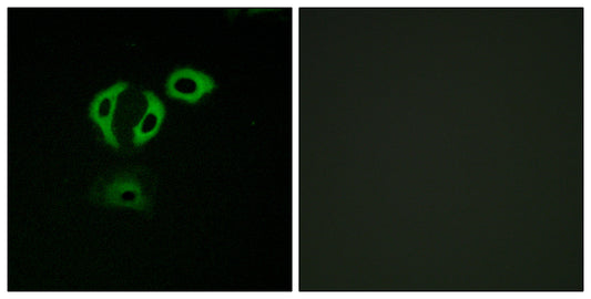 TACC3 Rabbit Polyclonal Antibody