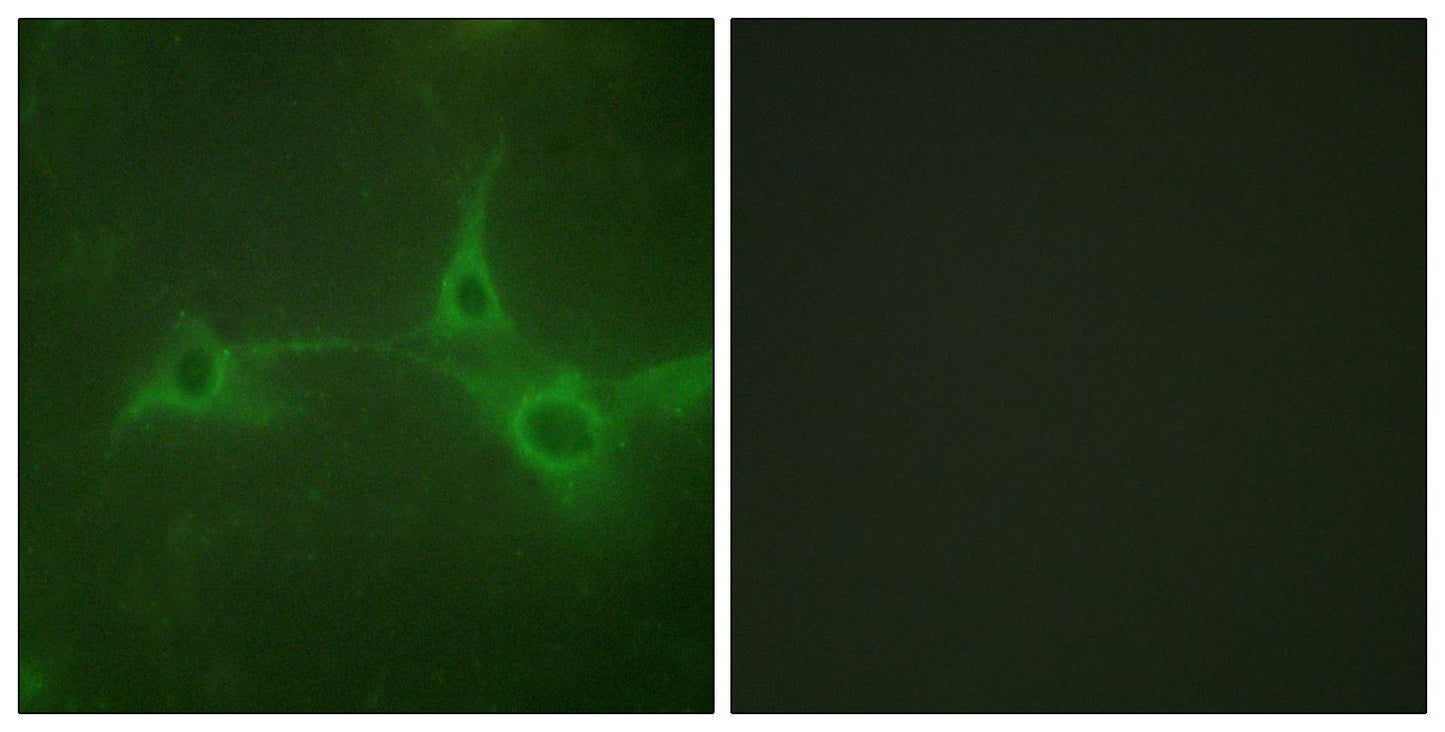 TACE Rabbit Polyclonal Antibody