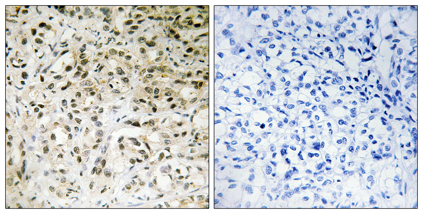 TAF II p100 Rabbit Polyclonal Antibody