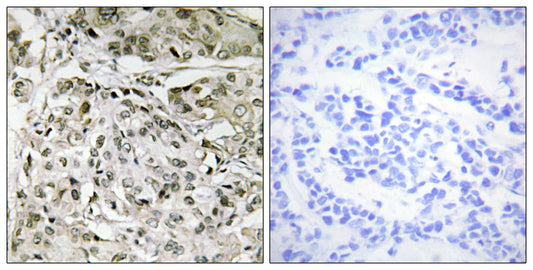TAF II p250 Rabbit Polyclonal Antibody