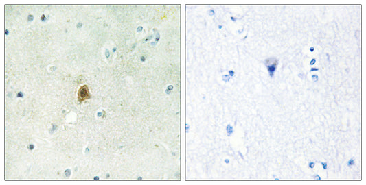 TAF II p68 Rabbit Polyclonal Antibody