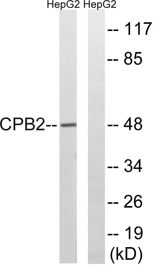 TAFI Rabbit Polyclonal Antibody
