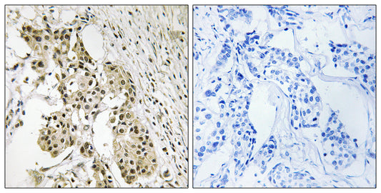 TAGAP Rabbit Polyclonal Antibody