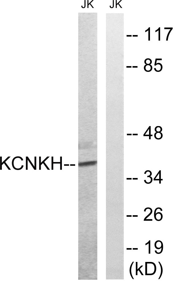 TALK-2 Rabbit Polyclonal Antibody