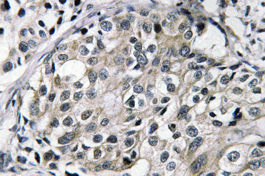 TAT Rabbit Polyclonal Antibody