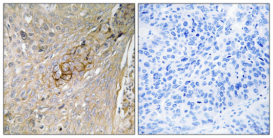 TAUT Rabbit Polyclonal Antibody