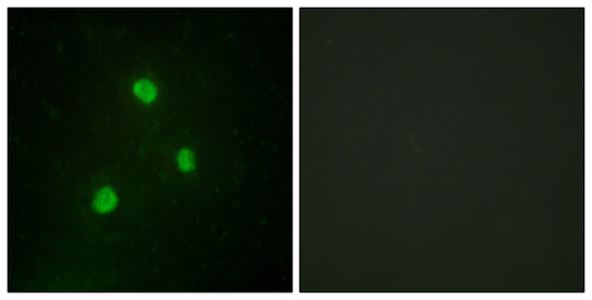 TBX1 Rabbit Polyclonal Antibody