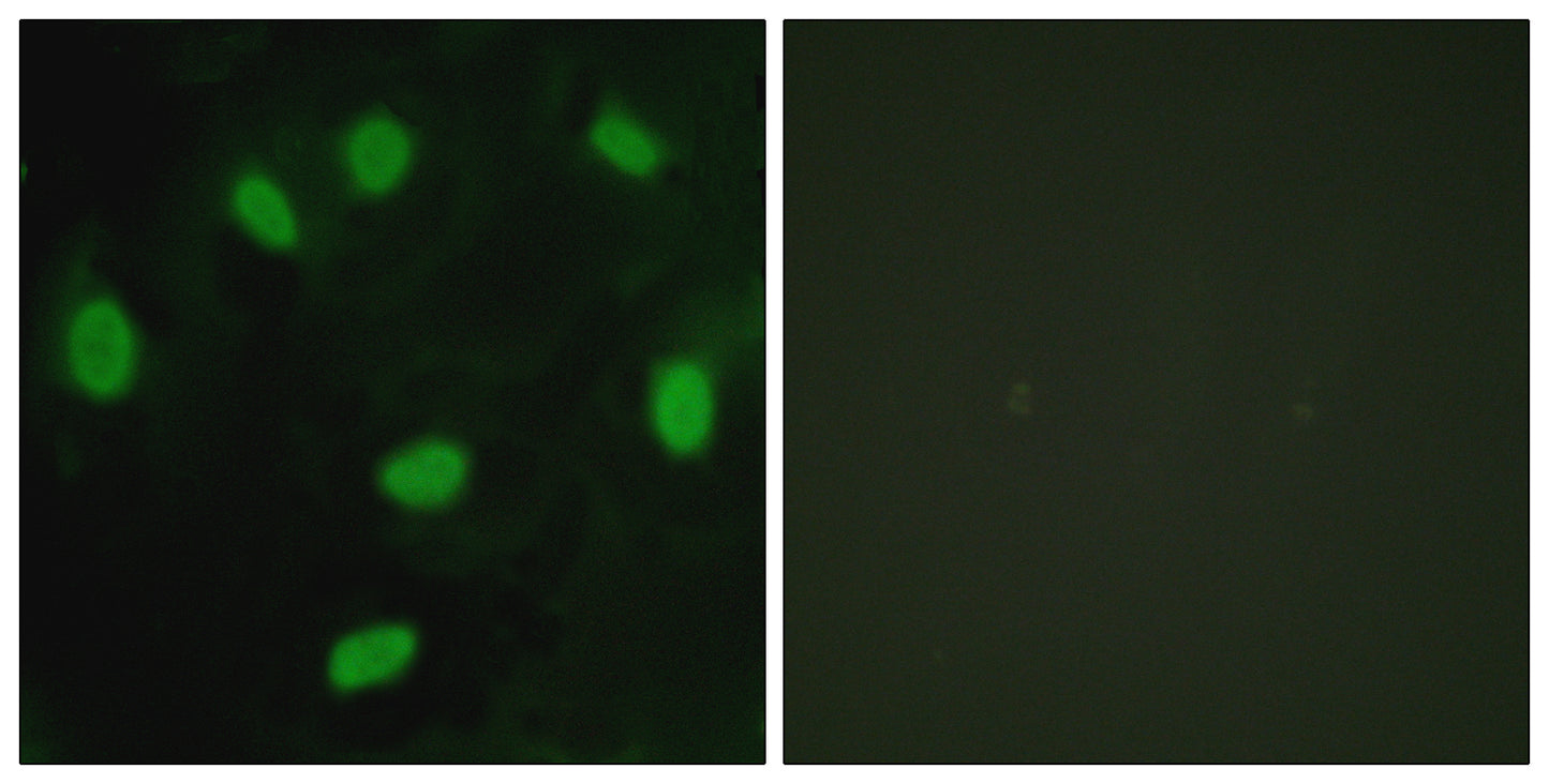 TBX15/18 Rabbit Polyclonal Antibody