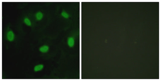 TBX15/18 Rabbit Polyclonal Antibody