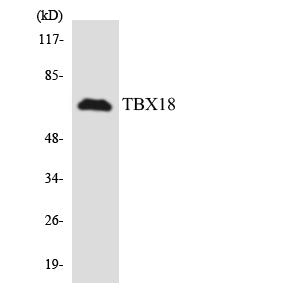 TBX18 Rabbit Polyclonal Antibody