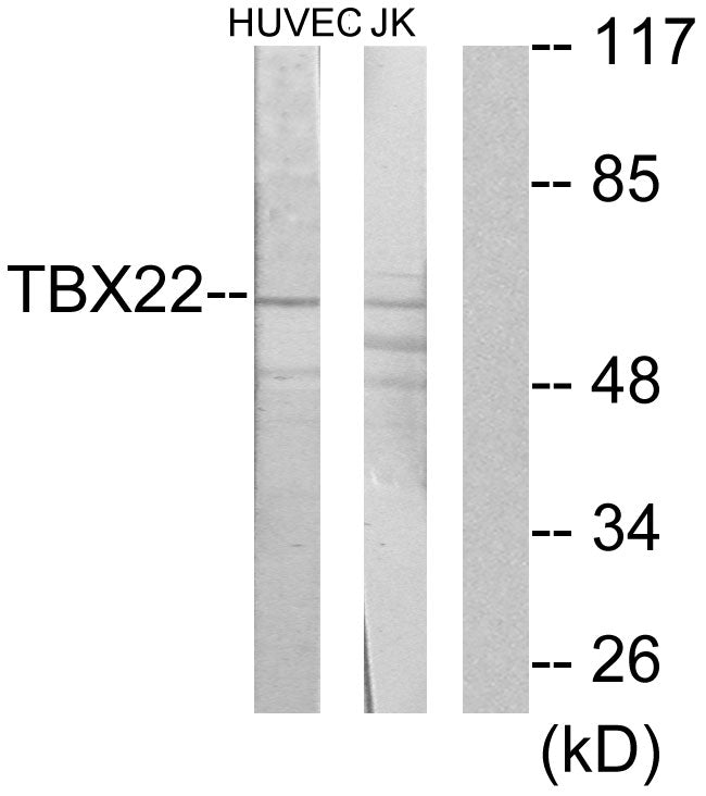 TBX22 Rabbit Polyclonal Antibody