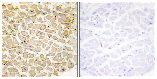 T-cadherin Rabbit Polyclonal Antibody