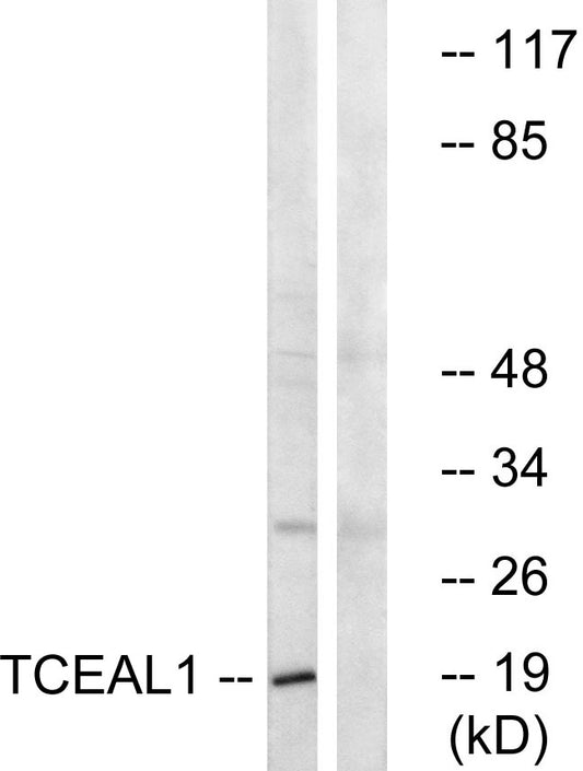 TCEAL1 Rabbit Polyclonal Antibody