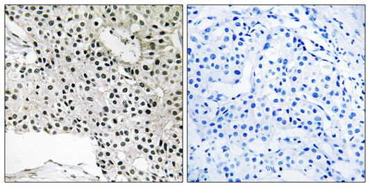 TCEAL4 Rabbit Polyclonal Antibody