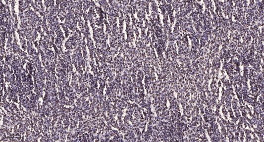 TCEAL7 Rabbit Polyclonal Antibody