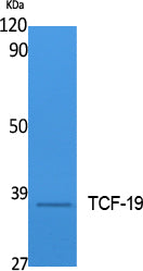 TCF-19 Rabbit Polyclonal Antibody
