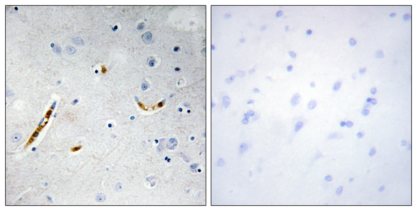 TCF-3 Rabbit Polyclonal Antibody