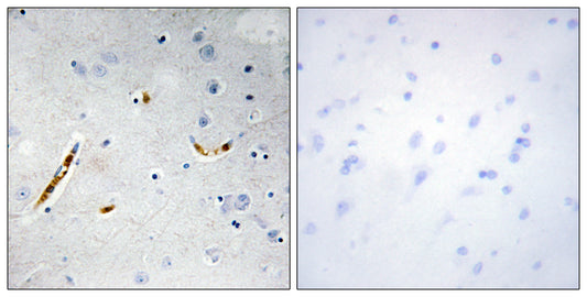 TCF-3 Rabbit Polyclonal Antibody