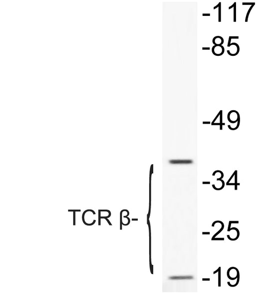 TCR β Rabbit Polyclonal Antibody