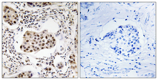 Tctex5 Rabbit Polyclonal Antibody