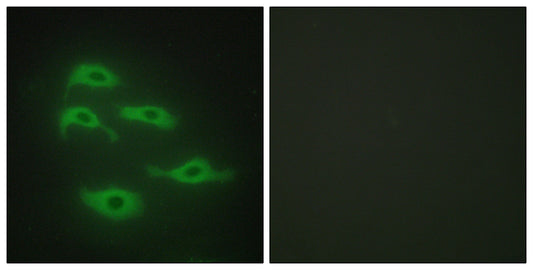 TDE1 Rabbit Polyclonal Antibody