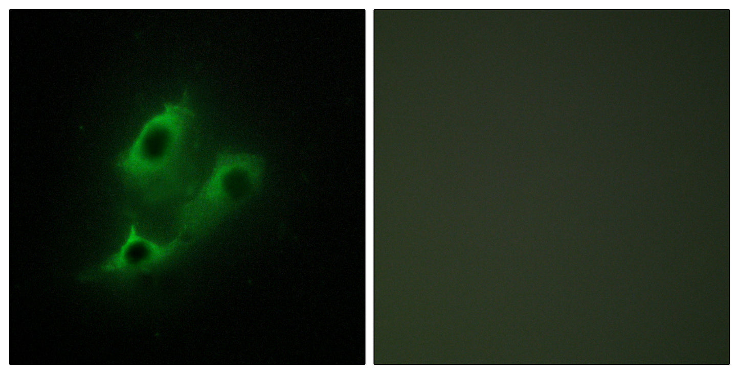 TDE2L Rabbit Polyclonal Antibody