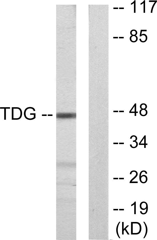 TDG Rabbit Polyclonal Antibody