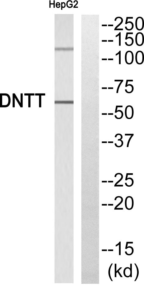TdT Rabbit Polyclonal Antibody