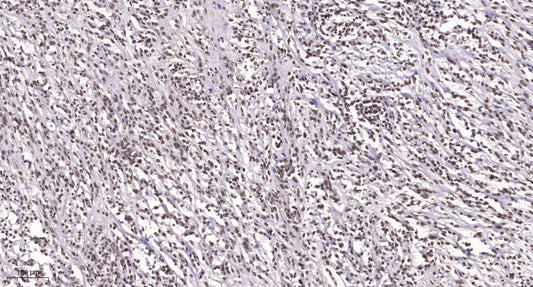 TEF-1 Rabbit Polyclonal Antibody