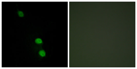 TEF-4 Rabbit Polyclonal Antibody