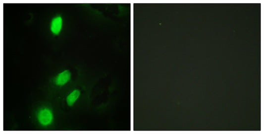 TEL Rabbit Polyclonal Antibody