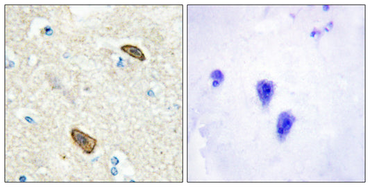 TEM7 Rabbit Polyclonal Antibody