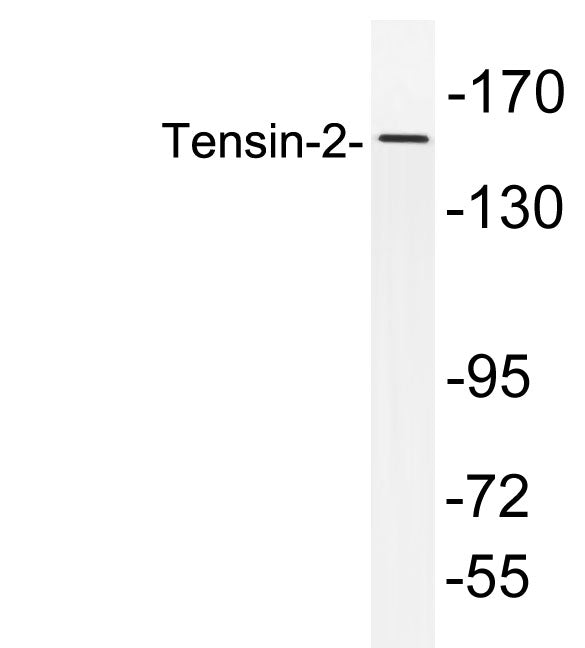 Tensin-2 Rabbit Polyclonal Antibody