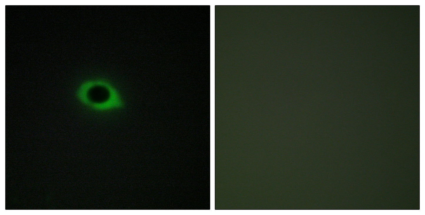 Tensin3 Rabbit Polyclonal Antibody