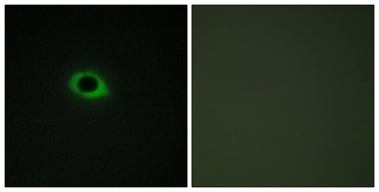 Tensin3 Rabbit Polyclonal Antibody