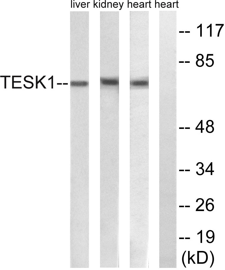 TESK1 Rabbit Polyclonal Antibody