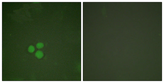 TFDP1 Rabbit Polyclonal Antibody