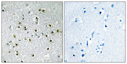 TFE3 Rabbit Polyclonal Antibody