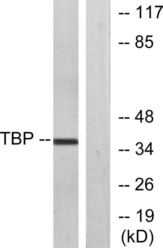 TFIID Rabbit Polyclonal Antibody