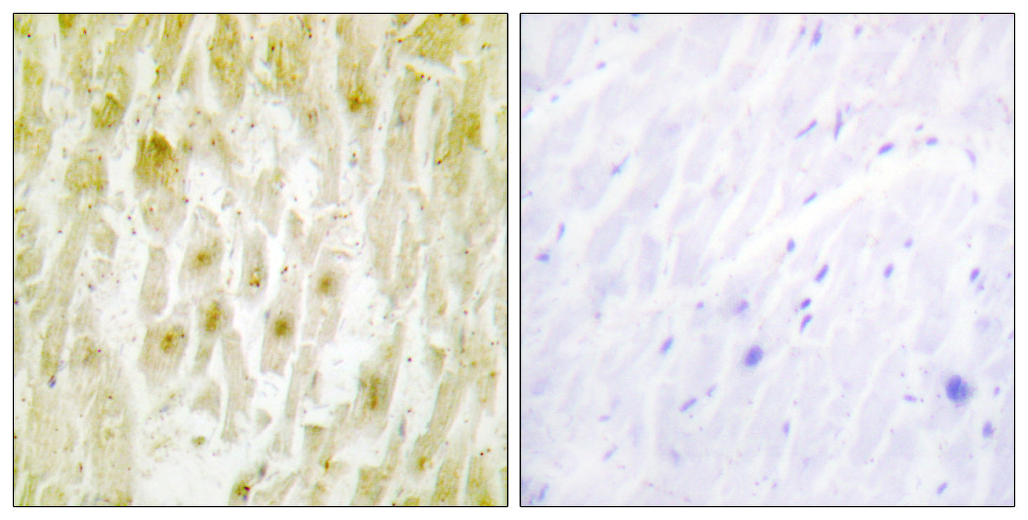 TFIIE-β Rabbit Polyclonal Antibody