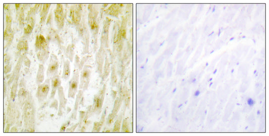 TFIIE-β Rabbit Polyclonal Antibody