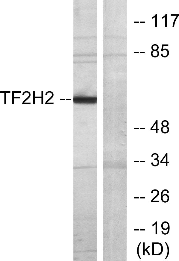 TFIIH p44 Rabbit Polyclonal Antibody