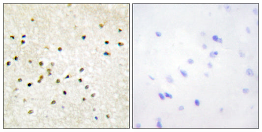 TFIIH p62 Rabbit Polyclonal Antibody