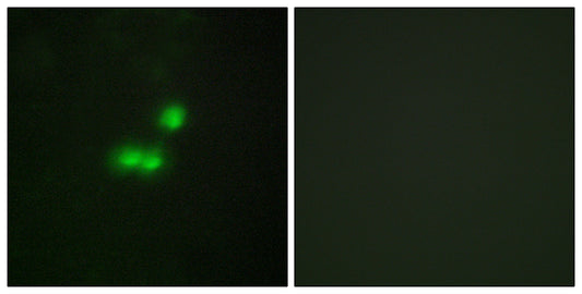 TFIIIB90-1 Rabbit Polyclonal Antibody